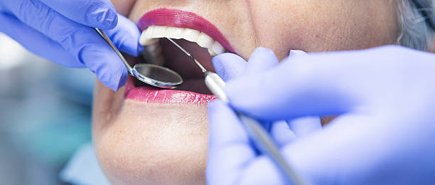 Best Knocked-Out Tooth (Avulsed Tooth) Treatment in Seymour, TX